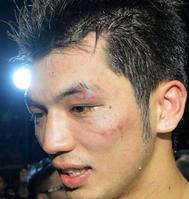 8回TKO勝ちも、パンチを浴びて顔を腫らした村田諒太=両国国技館(撮影・吉澤敬太)