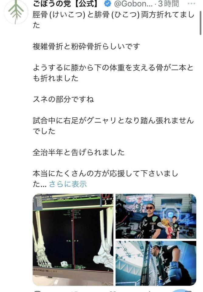 　ごぼうの党のＸ＠ＧｏｂｏｎｏｔｏＪＰより