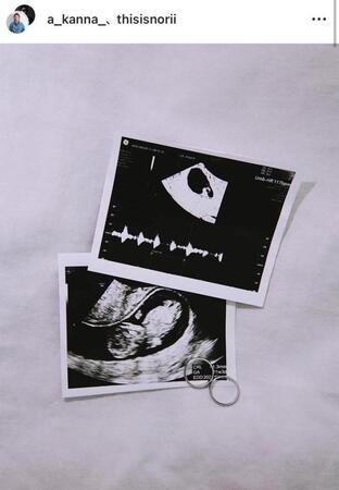 浅倉カンナのインスタグラム（ａ＿ｋａｎｎａ＿）より