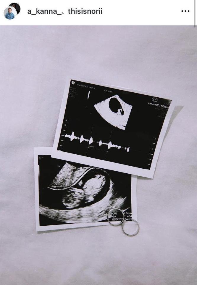 浅倉カンナのインスタグラム（ａ＿ｋａｎｎａ＿）より