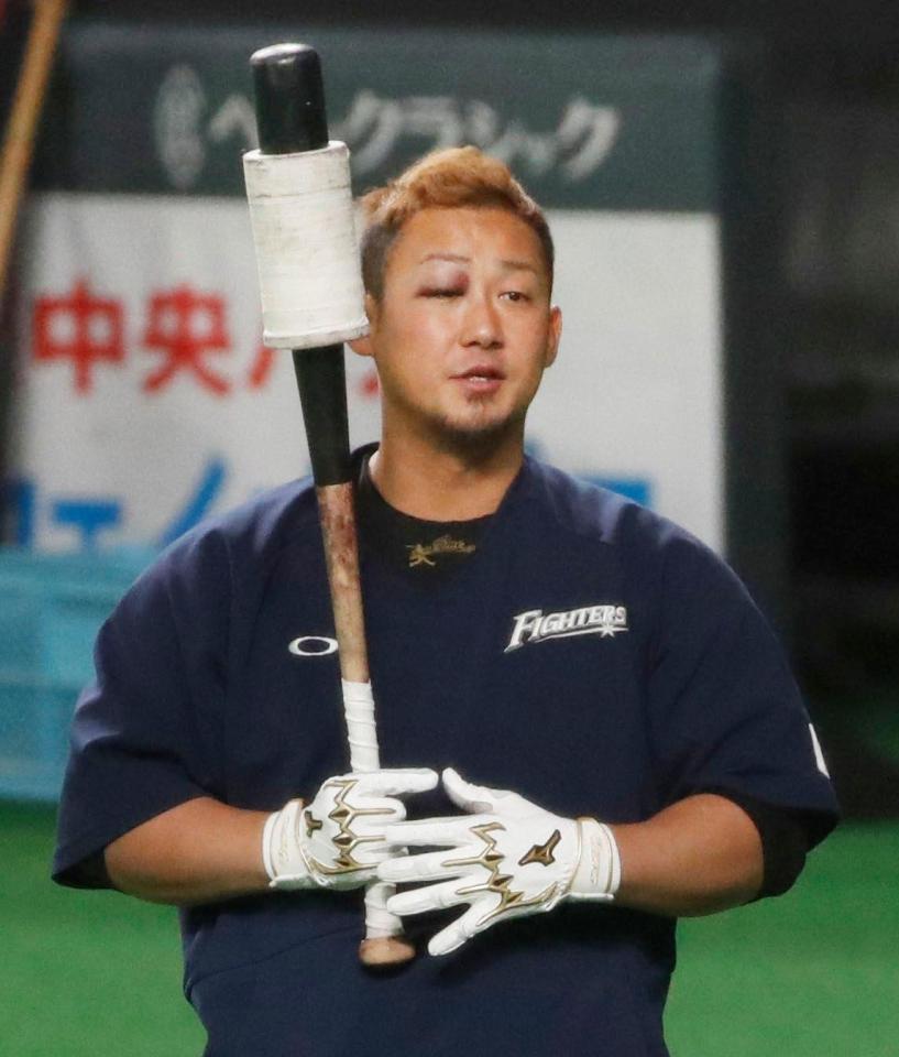 ７日の試合中にベンチ裏でつまずき転倒し、右目を強打して先発を外れた日本ハム・中田＝札幌ドーム