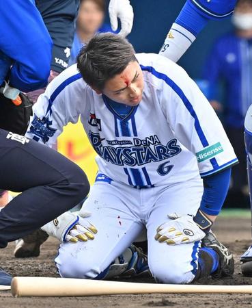 　紅白戦で坂本のボールを頭部に受け、出血した森