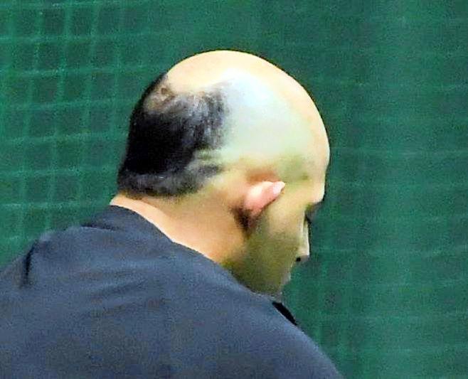 　阿部監督が「ロナウドみたいだな」と表現したオドーアのヘアスタイル（撮影・佐藤厚）