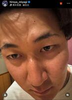宮城大弥インスタグラム（ｈｉｒｏｙａ＿ｍｉｙａｇｉ）より