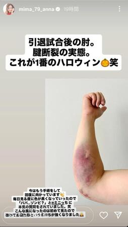 美馬アンナのインスタグラム（＠ｍｉｍａ＿７９＿ａｎｎａ）から