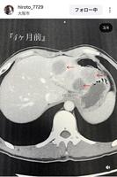 福森大翔さんのインスタグラム（＠ｈｉｒｏｔｏ＿７７２９）から