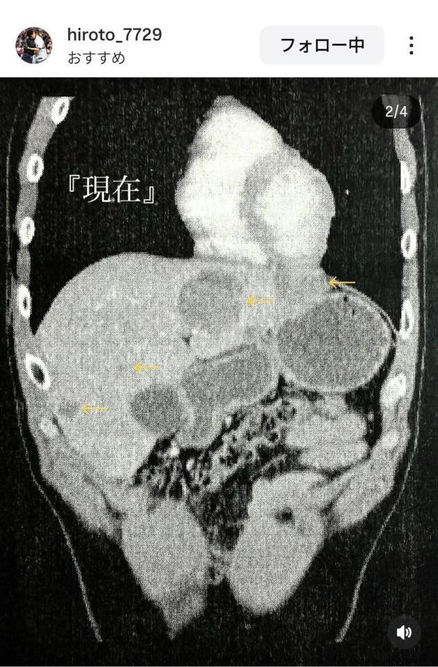 福森大翔さんのインスタグラム（＠ｈｉｒｏｔｏ＿７７２９）から