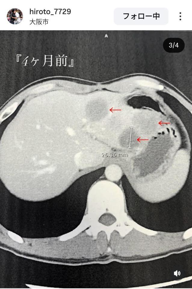 福森大翔さんのインスタグラム（＠ｈｉｒｏｔｏ＿７７２９）から