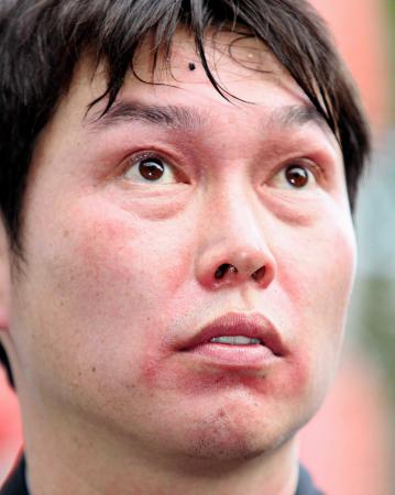 　顔中が真っ赤に腫れ上がった新井（撮影・出月俊成）