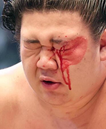 　流血しながら、琴勝峰をはたき込みで下した藤ノ川