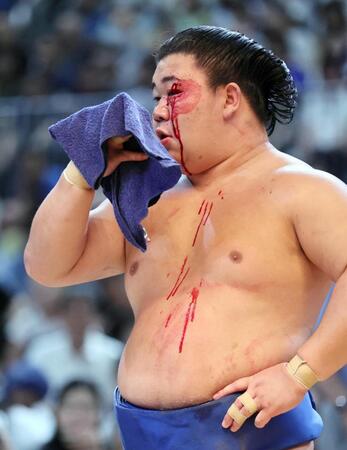 　流血しながら、琴勝峰をはたき込みで下した藤ノ川