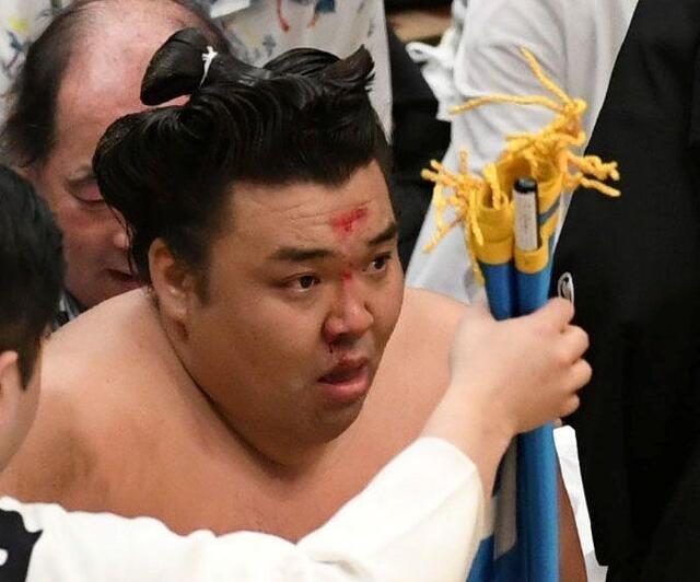 大関・霧島　顔から流血のアクシデント