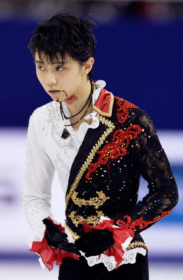 男子フリーの直前練習中に中国選手と激突し、流血した羽生結弦（共同）