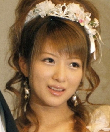 円形脱毛症を告白した辻希美