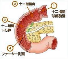 十二指腸とファーター乳頭のイメージ図