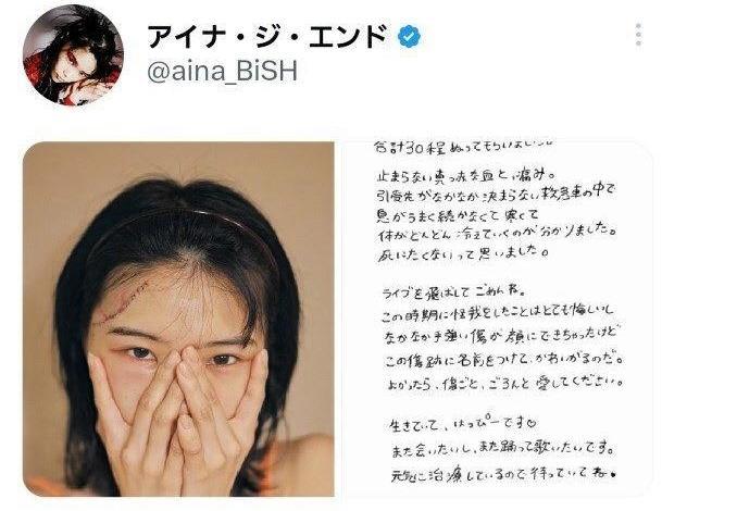 頭部負傷のアイナ・ジ・エンド、計30針縫う大けがだった 生々しい傷跡「死にたくないと思った」 芸能 デイリースポーツ Online