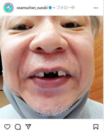 　鈴木おさむ氏のインスタグラム＠ｏｓａｍｕｃｈａｎ＿ｓｕｚｕｋｉより