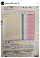 なぜ？？意外なアレルギー検査の結果。柄本時生のインスタグラム＠ｅｍｏｔｏｔｏｋｉｏ１９８９より
