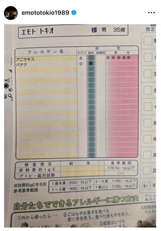 なぜ？？意外なアレルギー検査の結果。柄本時生のインスタグラム＠ｅｍｏｔｏｔｏｋｉｏ１９８９より