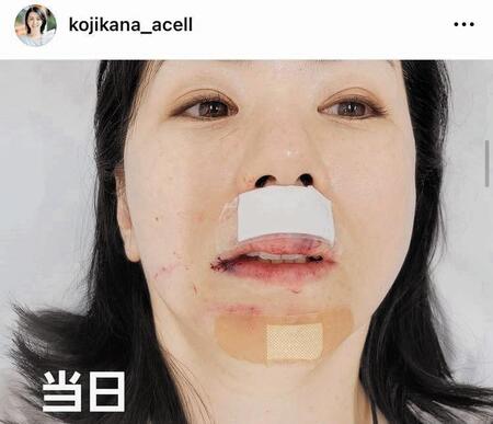 　小島可奈子のインスタグラム＠ｋｏｊｉｋａｎａ＿ａｃｅｌｌ（６月９日付）より