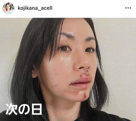 　小島可奈子のインスタグラム＠ｋｏｊｉｋａｎａ＿ａｃｅｌｌ（６月９日付）より