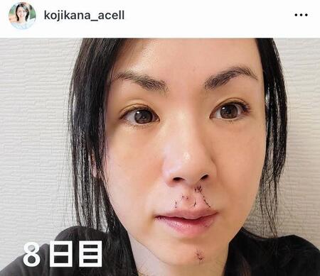 　小島可奈子のインスタグラム＠ｋｏｊｉｋａｎａ＿ａｃｅｌｌ（６月９日付）より