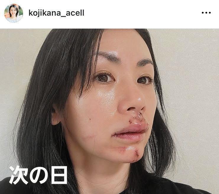 　小島可奈子のインスタグラム＠ｋｏｊｉｋａｎａ＿ａｃｅｌｌ（６月９日付）より