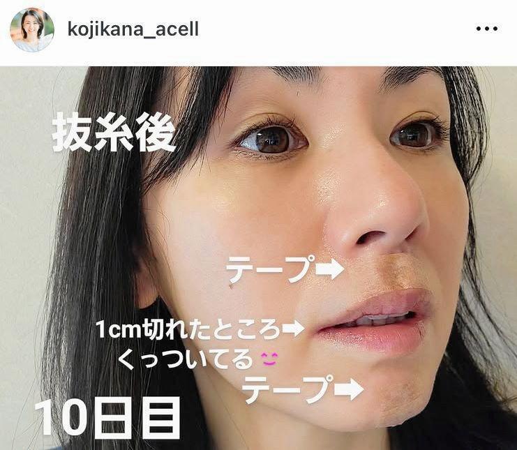 　小島可奈子のインスタグラム＠ｋｏｊｉｋａｎａ＿ａｃｅｌｌ（６月９日付）より