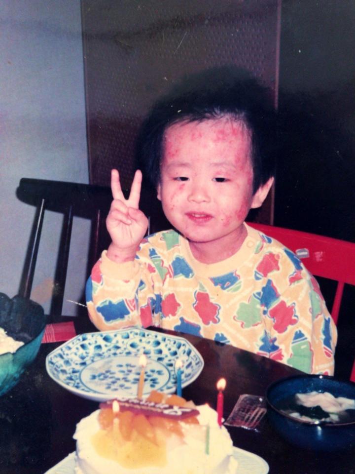 　アレルギーの症状により傷だらけの状態で５歳の誕生日を迎えた当時のちびシャトル