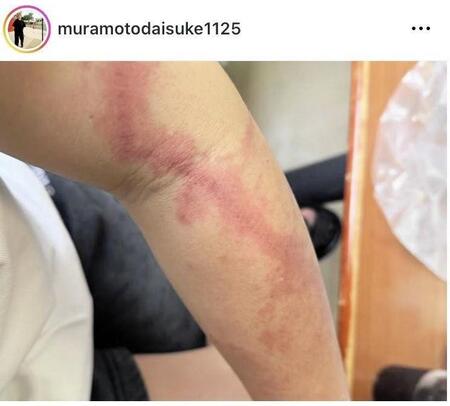 ウーマンラッシュアワー・村本大輔のインスタグラム（ｍｕｒａｍｏｔｏｄａｉｓｕｋｅ１１２５）より