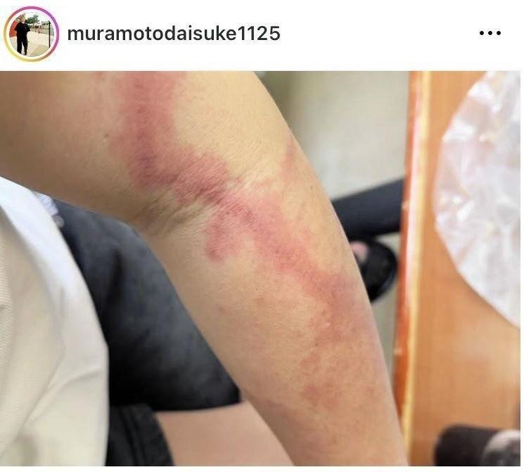 ウーマンラッシュアワー・村本大輔のインスタグラム（ｍｕｒａｍｏｔｏｄａｉｓｕｋｅ１１２５）より