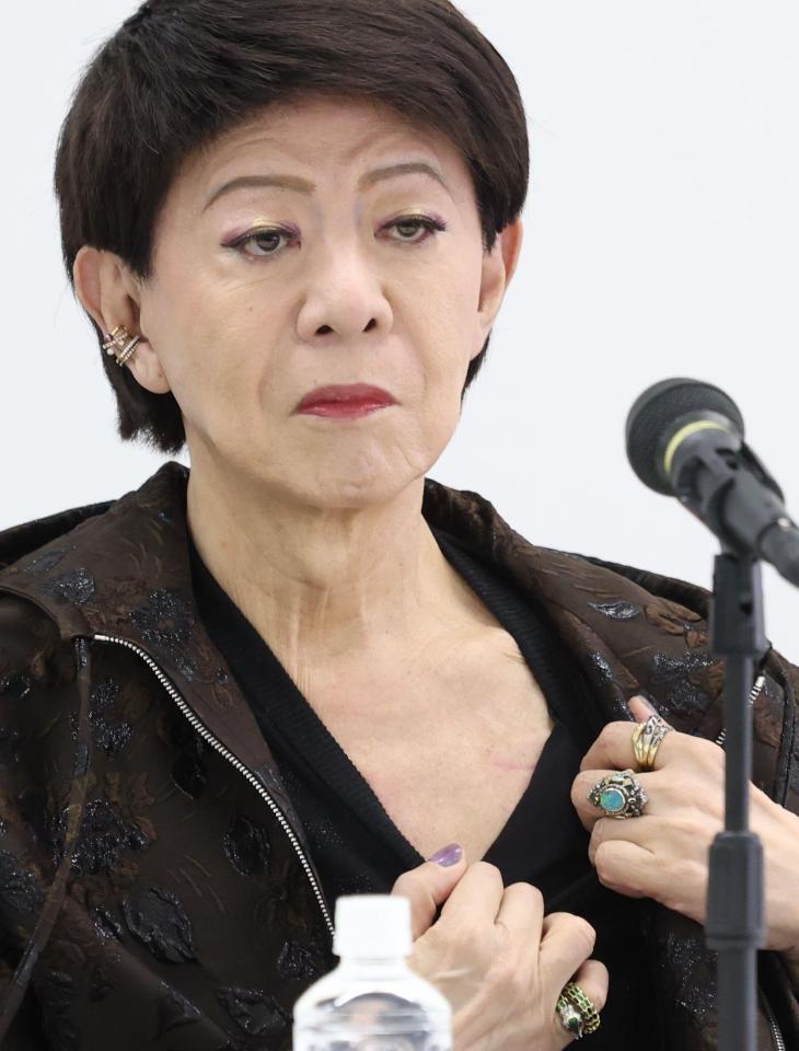 　心臓にペースメーカー入れた手術跡を見せる美川憲一（撮影・金田祐二）