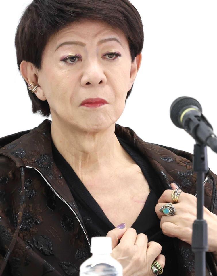 　心臓にペースメーカー入れた手術跡を見せる