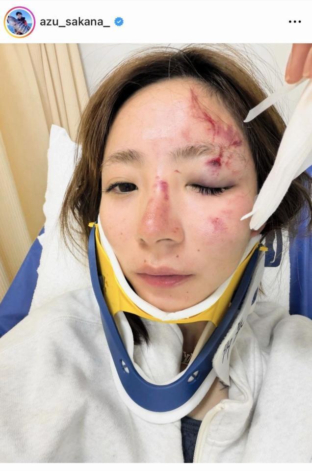 神野梓のインスタグラム＠ａｚｕ＿ｓａｋａｎａ＿より