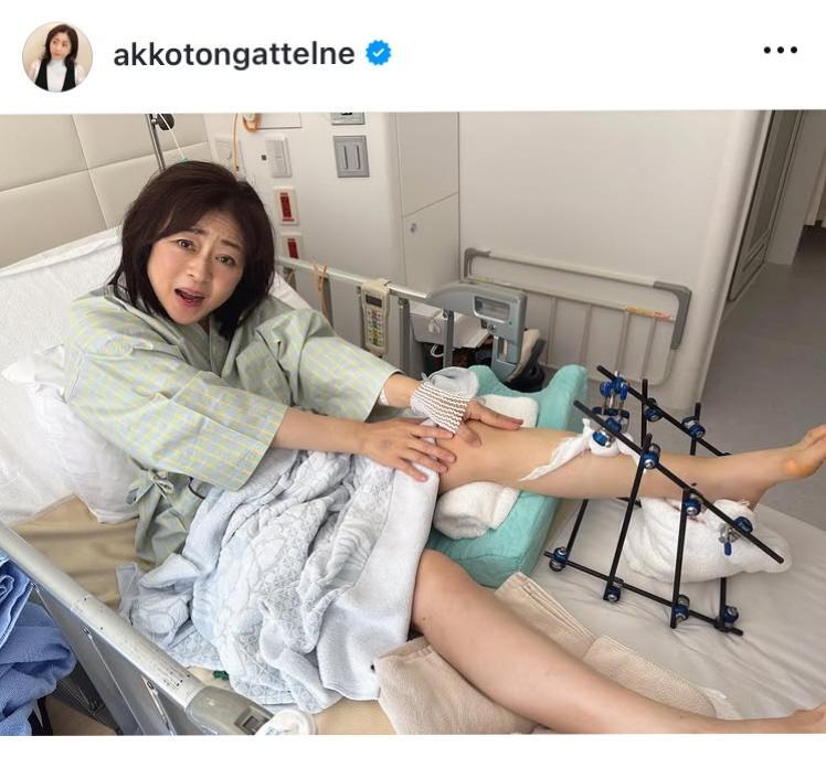 松本明子のインスタグラム＠ａｋｋｏｔｏｎｇａｔｔｅｌｎｅより