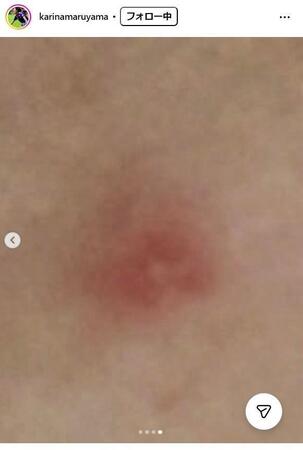 丸山桂里奈のインスタグラム＠ｋａｒｉｎａｍａｒｕｙａｍａより