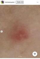 丸山桂里奈のインスタグラム＠ｋａｒｉｎａｍａｒｕｙａｍａより