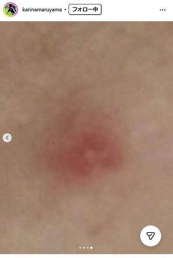 丸山桂里奈のインスタグラム＠ｋａｒｉｎａｍａｒｕｙａｍａより