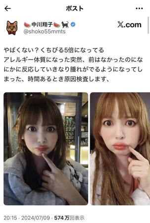 中川翔子のＸ＠shoko55mmtsから（２０２４年７月９日付）