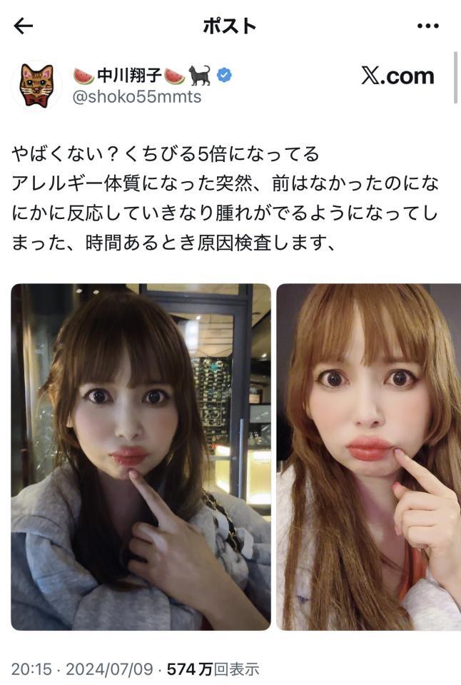 中川翔子のＸ＠shoko55mmtsから（２０２４年７月９日付）
