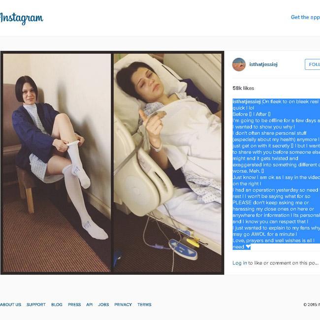インスタグラムで手術について明かしたジェシー・Ｊ