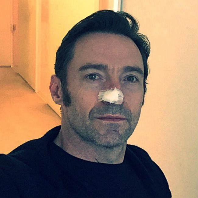 ヒュー・ジャックマン、再び皮膚がんの治療
