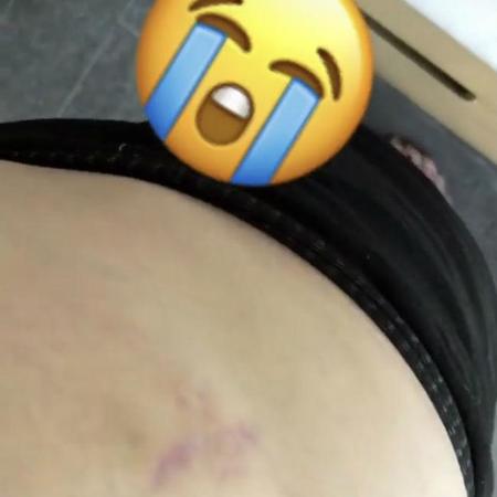クリッシー・テイゲンの妊娠線(c)Instagram