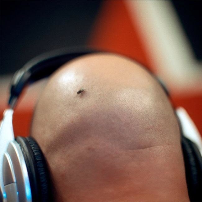 エナジードリンク、男性の抜け毛が増える？（写真はイメージです）