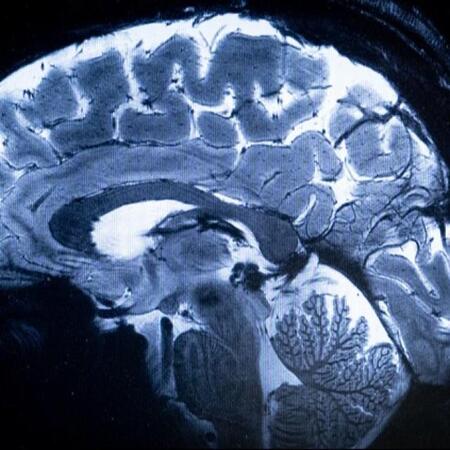 脳の断面図※イメージ画像