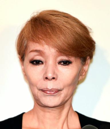 研ナオコ 仕事場で転倒し右腕ケガ 病気 けが デイリースポーツオンライン