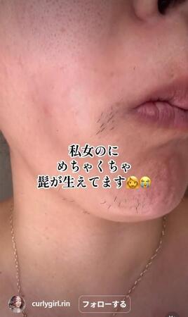 女性なのにヒゲが…勇気ある告白が話題に（カーリーガールリンさん提供）