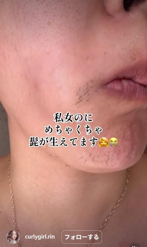 女性なのにヒゲが…勇気ある告白が話題に（カーリーガールリンさん提供）