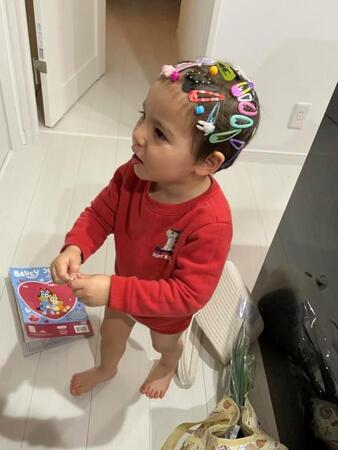 頭中にヘアピン！ （ YUIKA NEEEEEEさん　提供）