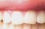 　白い歯は人それぞれなんですね